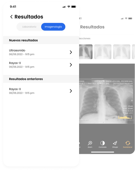 Interior de pagina web en sección de resultados con recuadros blancos con gris e imagen de estudio de rayos x al fondo.
